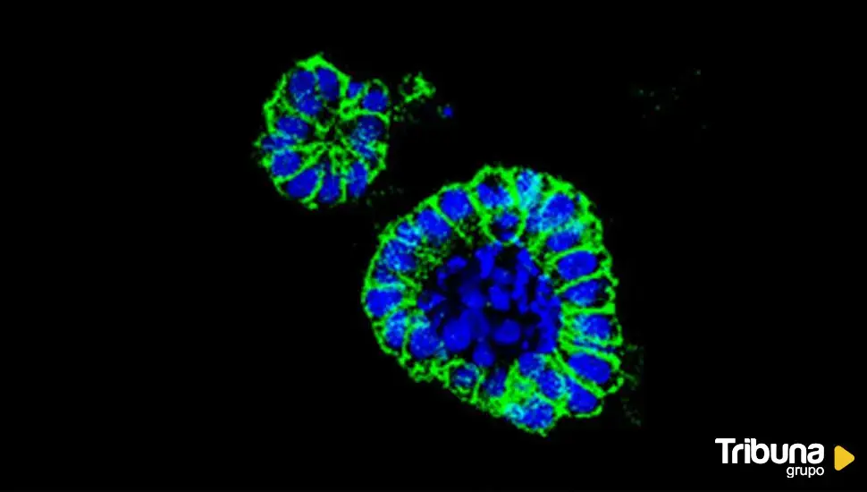 Los investigadores contra el cáncer asesinados